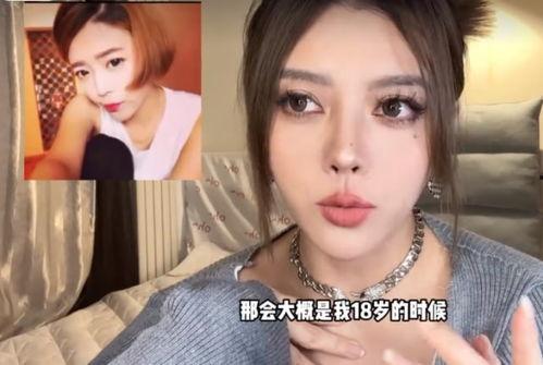 网红整容鼻子失败烂了,鼻子烂掉，美丽代价令人唏嘘